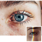 EMDR